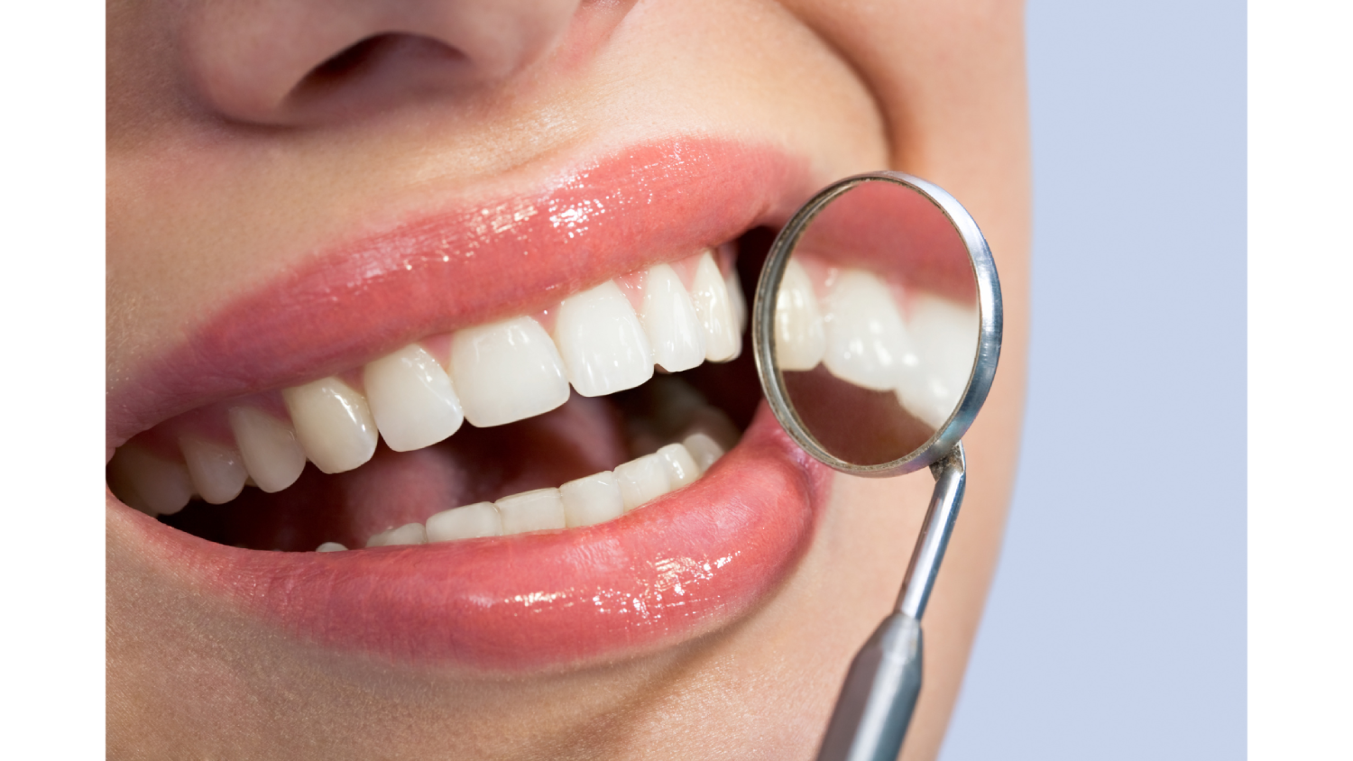 Teeth whitening treatment in coimbatore